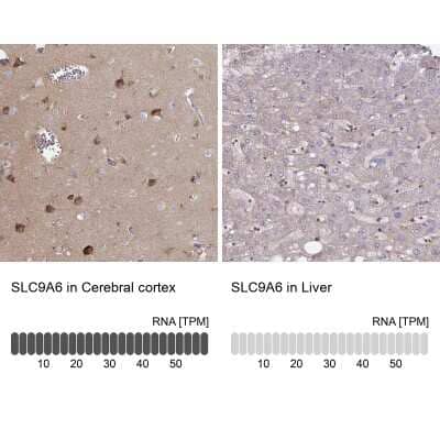 Immunohistochemistry-Paraffin: NHE6/SLC9A6 Antibody [NBP2-38877]