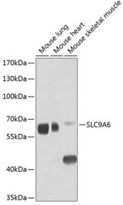 Western Blot: NHE6/SLC9A6 AntibodyBSA Free [NBP2-93987]