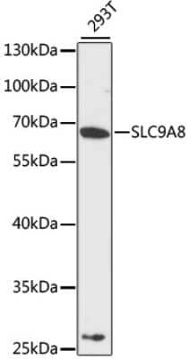 Western Blot: NHE8 AntibodyAzide and BSA Free [NBP2-93407]