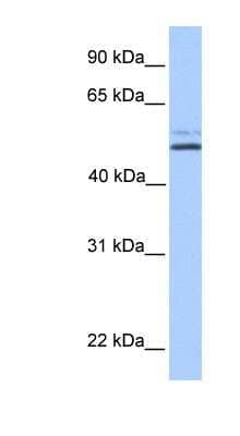 Western Blot: NHA2/SLC9B2/NHEDC2 Antibody [NBP1-59579]