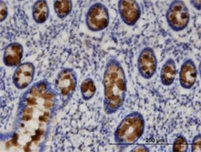 Immunohistochemistry-Paraffin: NHERF-1 Antibody (2B7) [H00009368-M02]