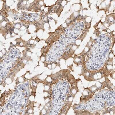 Immunohistochemistry-Paraffin: NHERF-1 Antibody [NBP1-84918]