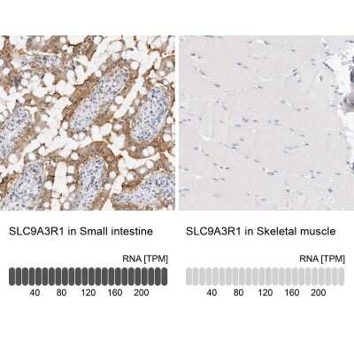 Immunohistochemistry-Paraffin: NHERF-1 Antibody [NBP1-84918]