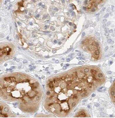 Immunohistochemistry-Paraffin: NHERF-1 Antibody [NBP1-84918]