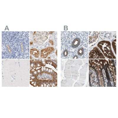 Immunohistochemistry-Paraffin: NHERF-1 Antibody [NBP1-84918]
