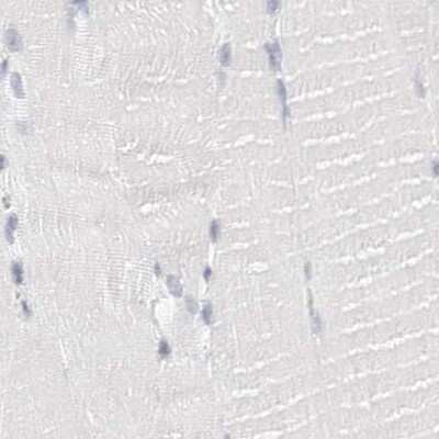 Immunohistochemistry-Paraffin: NHERF-1 Antibody [NBP1-84918]