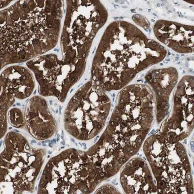 Immunohistochemistry-Paraffin: NHERF-1 Antibody [NBP1-84919]