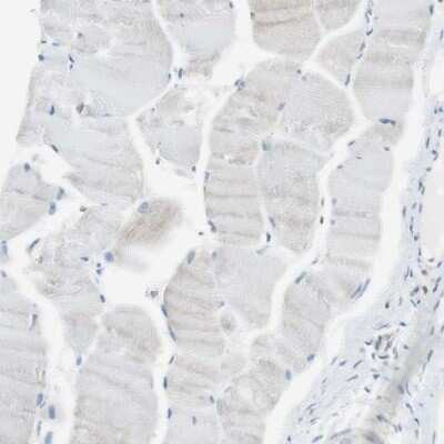 Immunohistochemistry-Paraffin: NHERF-1 Antibody [NBP1-84919]