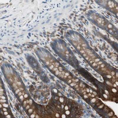 Immunohistochemistry-Paraffin: NHERF-1 Antibody [NBP1-84919]