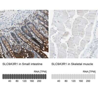 Immunohistochemistry-Paraffin: NHERF-1 Antibody [NBP1-84919]