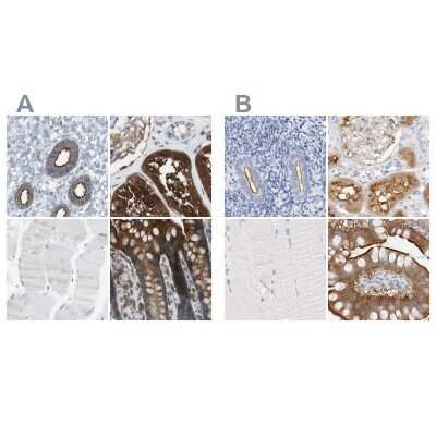 Immunohistochemistry-Paraffin: NHERF-1 Antibody [NBP1-84919]