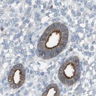 Immunohistochemistry-Paraffin: NHERF-1 Antibody [NBP1-84919]