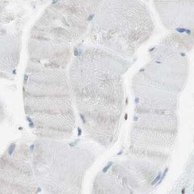 Immunohistochemistry-Paraffin: NHERF-1 Antibody [NBP1-84919]