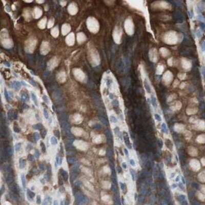 Immunohistochemistry-Paraffin: NHERF-1 Antibody [NBP1-84919]