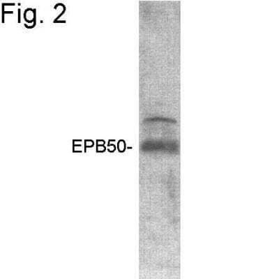 Western Blot: NHERF-1 Antibody [NB300-536]