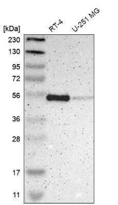 Western Blot: NHERF-1 Antibody [NBP1-84919]