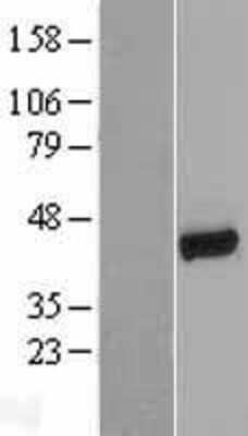 Western Blot: NHERF-1 Overexpression Lysate [NBL1-16198]