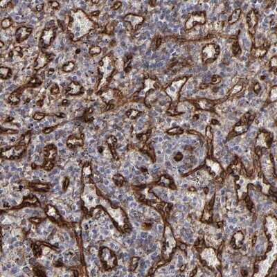 Immunohistochemistry-Paraffin: NHERF-2 Antibody [NBP1-84944]