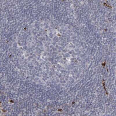 Immunohistochemistry-Paraffin: NHERF-2 Antibody [NBP1-84944]