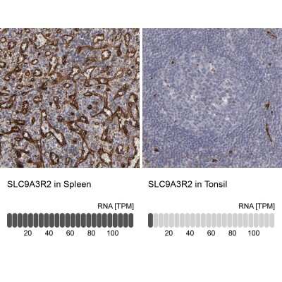 Immunohistochemistry-Paraffin: NHERF-2 Antibody [NBP1-84944]