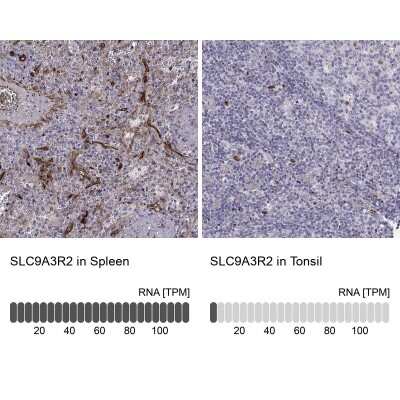 Immunohistochemistry-Paraffin: NHERF-2 Antibody [NBP2-62651]