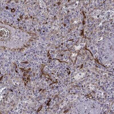 Immunohistochemistry-Paraffin: NHERF-2 Antibody [NBP2-62651]