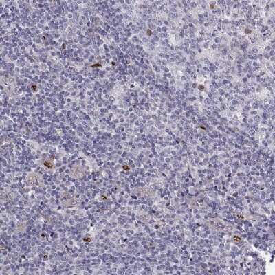 Immunohistochemistry-Paraffin: NHERF-2 Antibody [NBP2-62651]