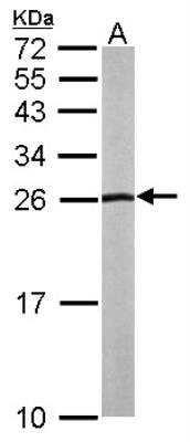Western Blot: NHERF-2 Antibody [NBP1-31804]