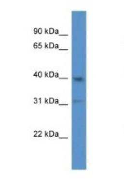 Western Blot: NHERF-2 Antibody [NBP1-91569]