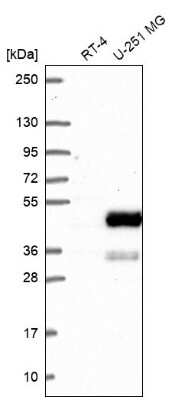 Western Blot: NHERF-2 Antibody [NBP2-62651]