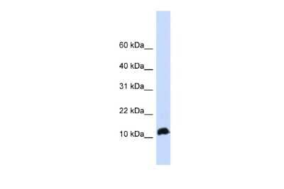 Western Blot: NHLH1 Antibody [NBP2-87915]