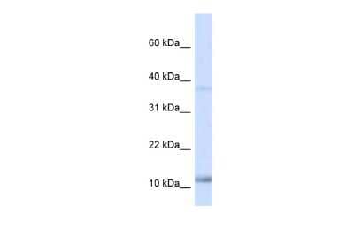 Western Blot: NHLH1 Antibody [NBP2-87916]