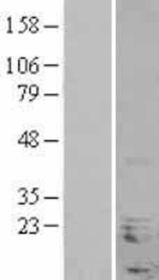 Western Blot: NHLH1 Overexpression Lysate [NBL1-13639]