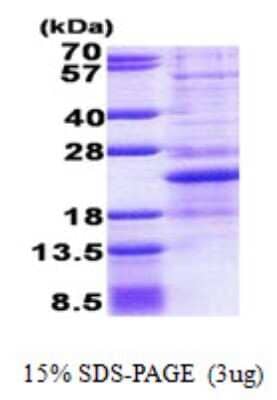 SDS-PAGE: Recombinant Human NHLH1 His Protein [NBP2-23275]