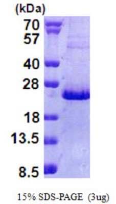 SDS-PAGE: Recombinant Human NHLH2 His Protein [NBP2-23276]