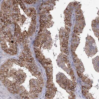 Immunohistochemistry-Paraffin: NHLRC2 Antibody [NBP1-85019]