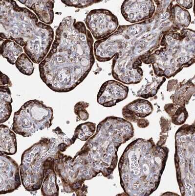Immunohistochemistry-Paraffin: NHLRC2 Antibody [NBP1-85019]