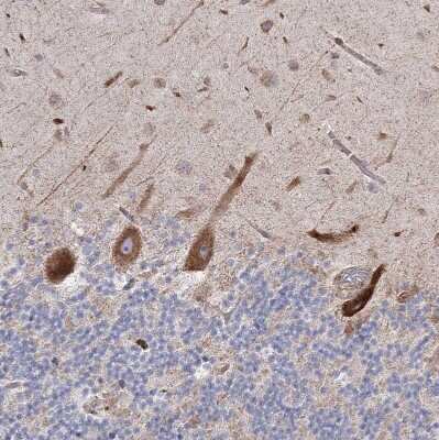 Immunohistochemistry-Paraffin: NHLRC2 Antibody [NBP1-85019]