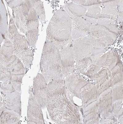 Immunohistochemistry-Paraffin: NHLRC2 Antibody [NBP1-85019]