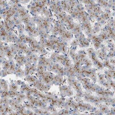 Immunohistochemistry-Paraffin: NHLRC3 Antibody [NBP1-86466]