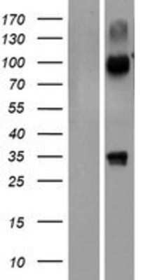 Western Blot: NHLRC3 Overexpression Lysate [NBP2-08664]