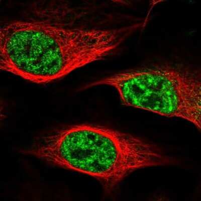 Immunocytochemistry/ Immunofluorescence: NHN1 Antibody [NBP1-82571]