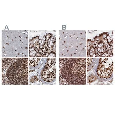 Immunohistochemistry-Paraffin: NHN1 Antibody [NBP1-82570]