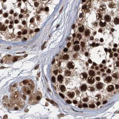 Immunohistochemistry-Paraffin: NHN1 Antibody [NBP1-82570]