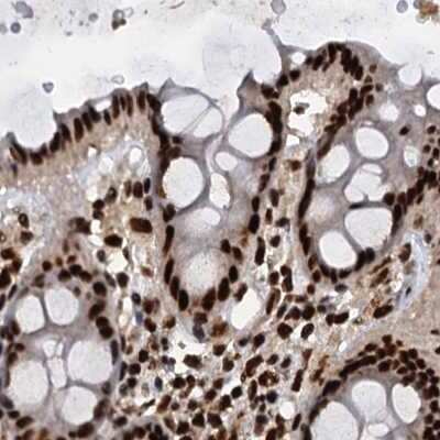 Immunohistochemistry-Paraffin: NHN1 Antibody [NBP1-82570]