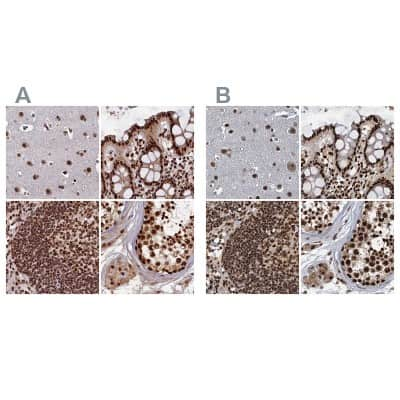 Immunohistochemistry-Paraffin: NHN1 Antibody [NBP1-82571]