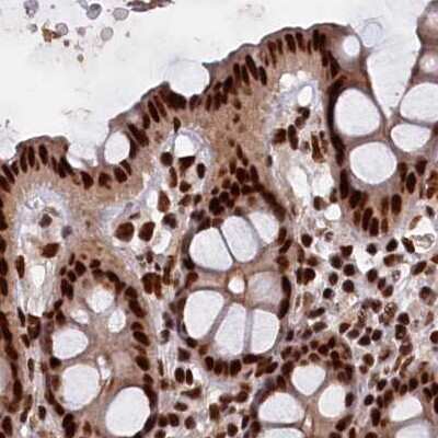 Immunohistochemistry-Paraffin: NHN1 Antibody [NBP1-82571]