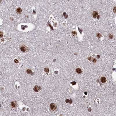 Immunohistochemistry-Paraffin: NHN1 Antibody [NBP1-82571]