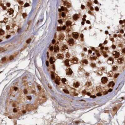 Immunohistochemistry-Paraffin: NHN1 Antibody [NBP1-82571]