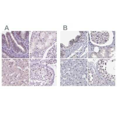 Immunohistochemistry-Paraffin: NHP2 Antibody [NBP2-13656]
